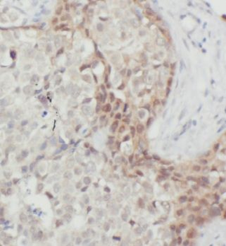MRPL9 Rabbit Polyclonal Antibody