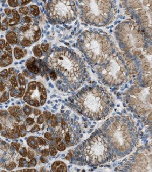 MRPS2 Rabbit Polyclonal Antibody