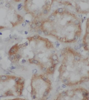 KGD4 Rabbit Polyclonal Antibody