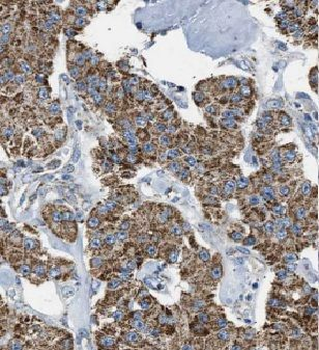 MS4A12 Rabbit Polyclonal Antibody