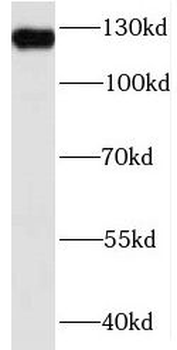 MSH3 Antibody
