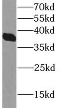 MSI2 Antibody