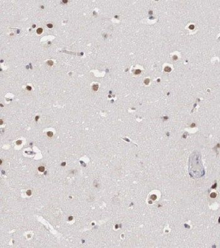 MTF2 Rabbit Polyclonal Antibody