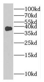 MTHFD2 Rabbit Polyclonal Antibody