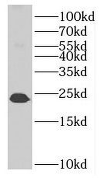 MTHFS Rabbit Polyclonal Antibody