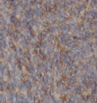 MTHFS Rabbit Polyclonal Antibody