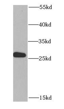 MTIF3 Antibody