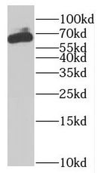 MTM1 Rabbit Polyclonal Antibody