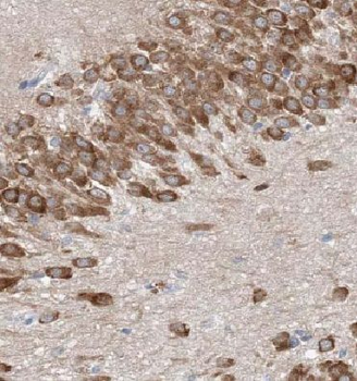 MTM1 Rabbit Polyclonal Antibody