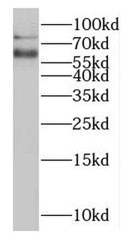 MTMR6 Antibody