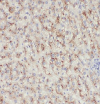MTMR6 Rabbit Polyclonal Antibody