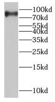 MTMR7 Antibody