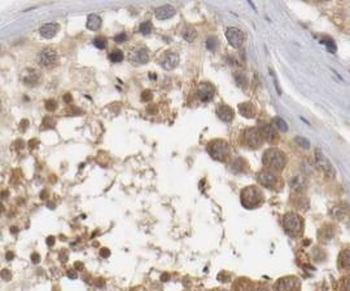 MTOR Rabbit Polyclonal Antibody