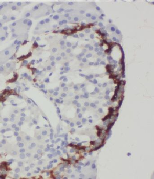 MTRF1 Rabbit Polyclonal Antibody