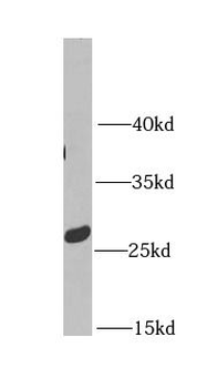 MTX2 Antibody