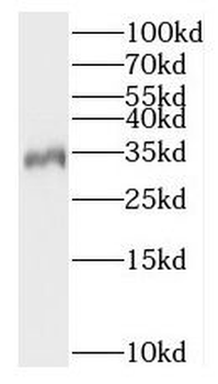 CRYM Rabbit Polyclonal Antibody