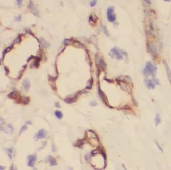 CRYM Rabbit Polyclonal Antibody