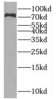 PWWP3A Antibody
