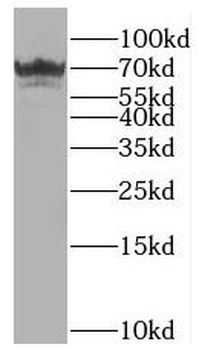 CDHR5 Rabbit Polyclonal Antibody
