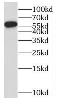 MUTYH Rabbit Polyclonal Antibody