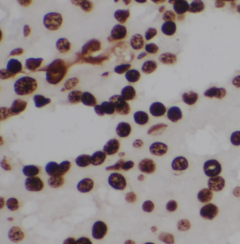 MUTYH Rabbit Polyclonal Antibody