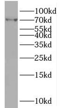 MVD Rabbit Polyclonal Antibody