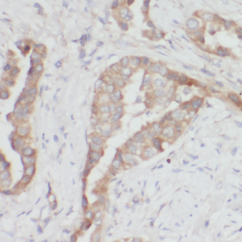 MVD Rabbit Polyclonal Antibody