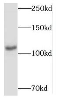MYCBPAP Antibody