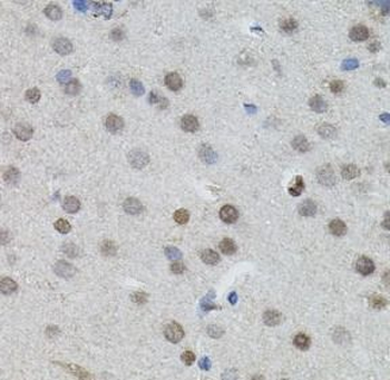 MYCN Rabbit Polyclonal Antibody