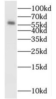MYEOV Rabbit Polyclonal Antibody