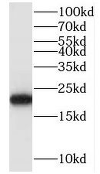 MYL9 Rabbit Polyclonal Antibody