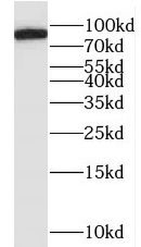 MYLK3 Antibody