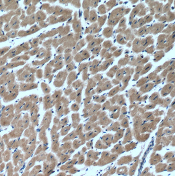 MYLK4 Rabbit Polyclonal Antibody