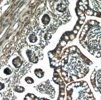 MYO1A Rabbit Polyclonal Antibody