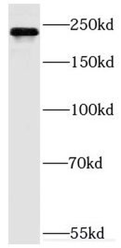 MYO9B Rabbit Polyclonal Antibody