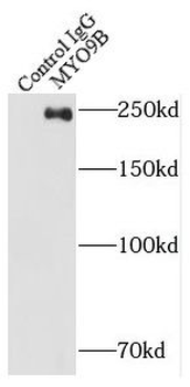 MYO9B Rabbit Polyclonal Antibody