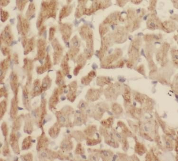 MB Rabbit Polyclonal Antibody