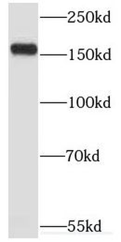 MYOM3 Rabbit Polyclonal Antibody