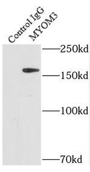 MYOM3 Rabbit Polyclonal Antibody