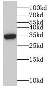 MYOZ3 Rabbit Polyclonal Antibody