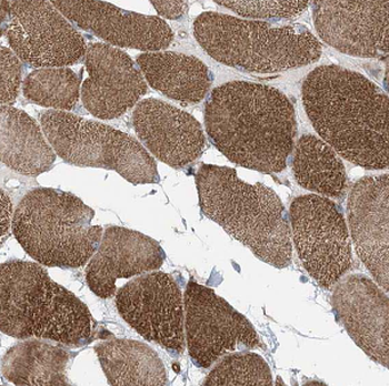 MYOZ3 Rabbit Polyclonal Antibody