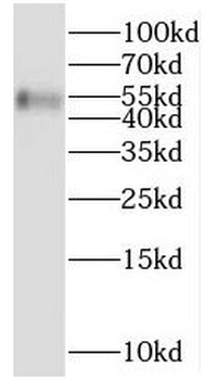 NADK Rabbit Polyclonal Antibody