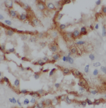 NADK Rabbit Polyclonal Antibody