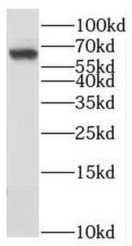 NAGS Rabbit Polyclonal Antibody