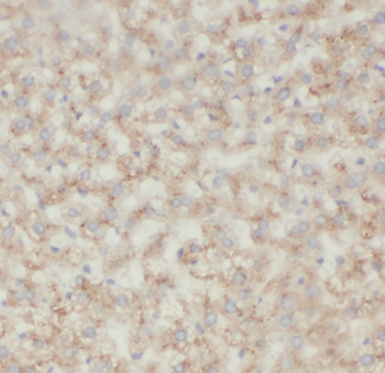 NAGS Rabbit Polyclonal Antibody