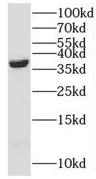 NANS Antibody
