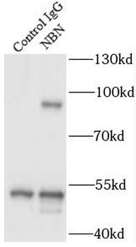 NBN Rabbit Polyclonal Antibody