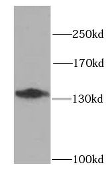 CDH2 Rabbit Polyclonal Antibody