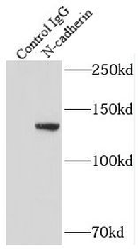 CDH2 Rabbit Polyclonal Antibody