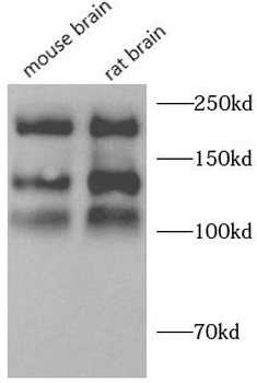NCAM1 Rabbit Polyclonal Antibody